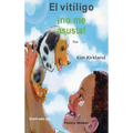 El vitiligo no me asusta