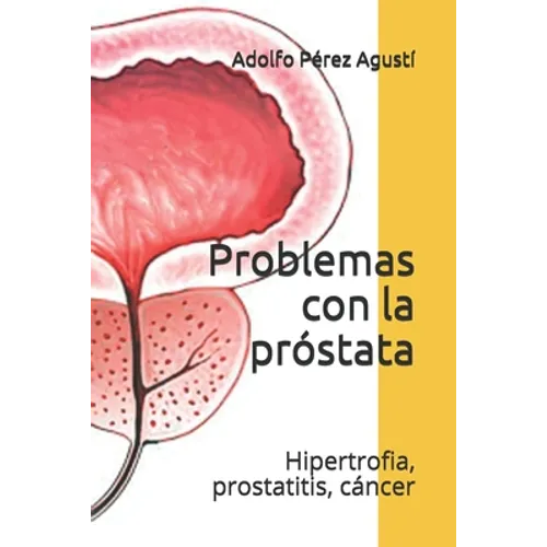 Problemas con la próstata: Hipertrofia, prostatitis, cáncer