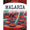 Malaria
