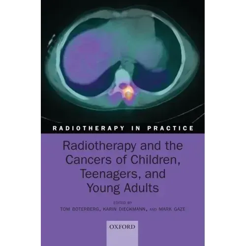Radiotherapy and the Cancers of Children, Teenagers and Young Adults