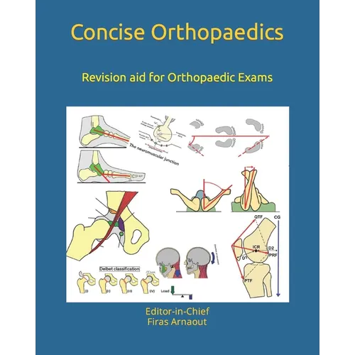 Concise Orthopaedic Notes: Revision aid for FRCS, EBOT , SICOT and Board Examinations