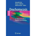 Onychomycosis: An Illustrated Guide to Diagnosis and Treatment