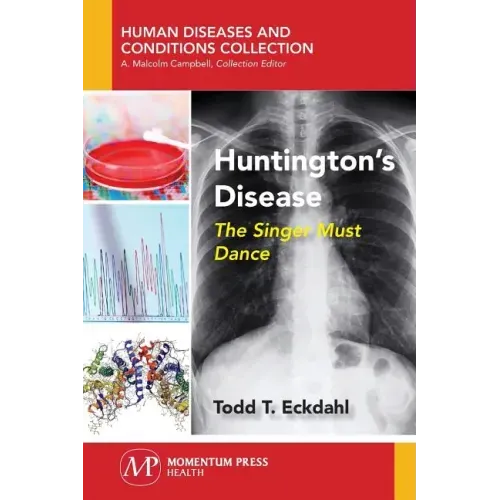 Huntington's Disease: The Singer Must Dance