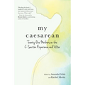 My Caesarean: Twenty-One Mothers on the C-Section Experience and After