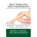 Best Varicose Vein Treatments: Natural Remedies That Work For Varicose