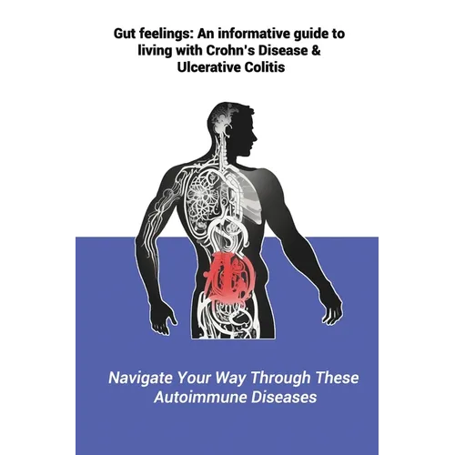 Gut feelings: An informative guide to living with Crohn's Disease and Ulcerative Colitis: Navigate Your Way Through These Autoimmune Diseases