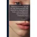 Photographic Atlas of the Diseases of the Skin With Descriptive Text, and a Treatise on Cutaneous Therapeutics