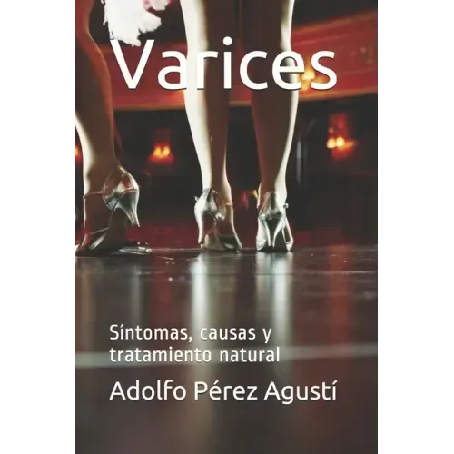 Varices: Síntomas, causas y tratamiento natural