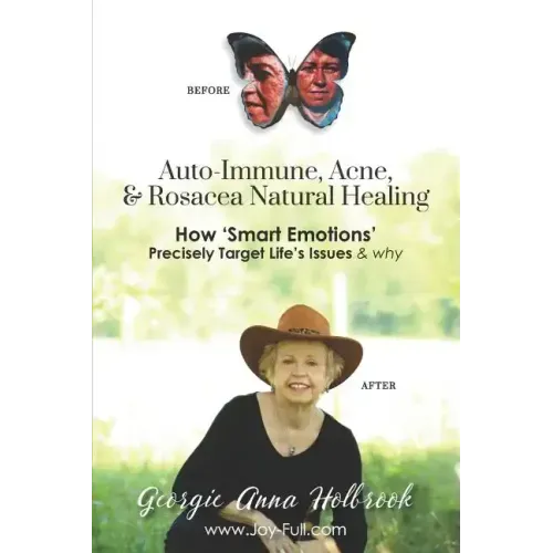 Auto-Immune, Acne, & Rosacea Natural Healing - How 'Smart Emotions' Precisely Target Life's Issues & Why