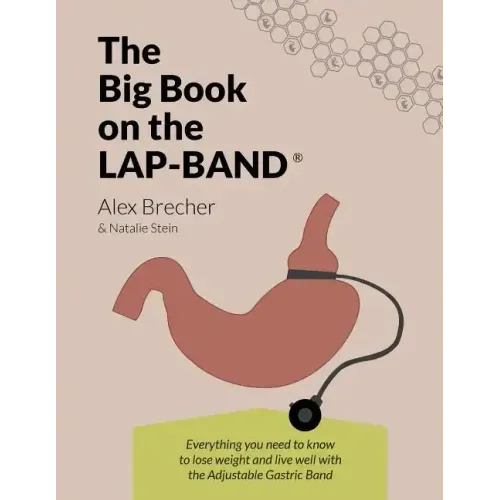 The Big Book on the Lap-Band: Everything You Need to Know to Lose Weight and Live Well with the Adjustable Gastric Band