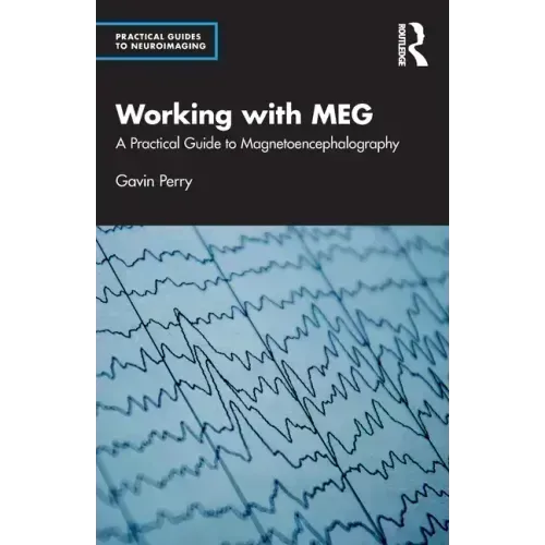 Working with Meg: A Practical Guide to Magnetoencephalography