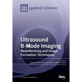Ultrasound B-Mode Imaging: Beamforming and Image Formation Techniques