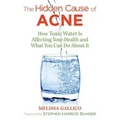 The Hidden Cause of Acne: How Toxic Water Is Affecting Your Health and What You Can Do about It