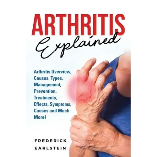 Arthritis Explained: Arthritis Overview, Causes, Types, Management, Prevention, Treatments, Effects, Symptoms, Causes and Much More!