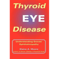 Thyroid Eye Disease: Understanding Graves' Ophthalmopathy
