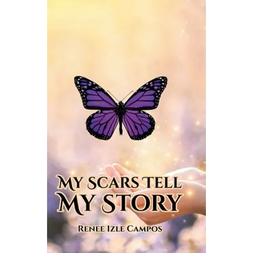 My Scars Tell My Story