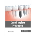Dental Implant Prosthetics