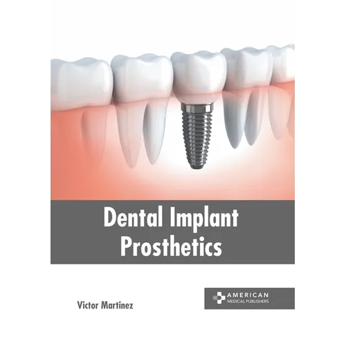 Dental Implant Prosthetics
