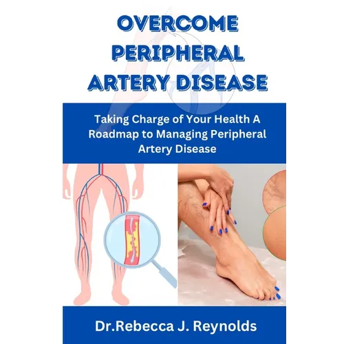 Overcome Peripheral Artery Disease: Taking Charge of Your Health A Roadmap to Managing Peripheral Artery Disease
