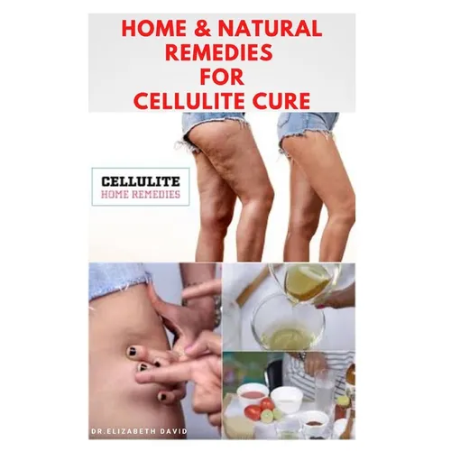 Home & Natural Remedies for Cellulite Cure: Practical Guide On The Best Remedies To Get Rid Of Your Cellulite: Everything You Need To Know