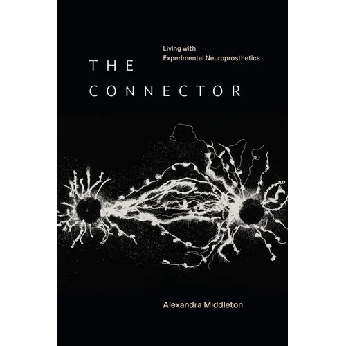 The Connector: Living with Experimental Neuroprosthetics