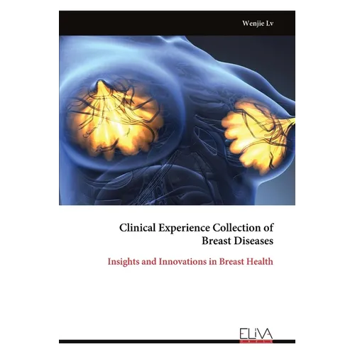 Clinical Experience Collection of Breast Diseases: Insights and Innovations in Breast Health