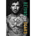 Beyond the Scars: Life Is Defined by Who You Are, Not Your Circumstances