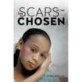 The Scars of the Chosen