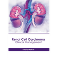 Renal Cell Carcinoma: Clinical Management