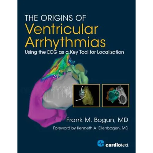 The Origins of Ventricular Arrhythmias: Using the ECG as a Key Tool for Localization