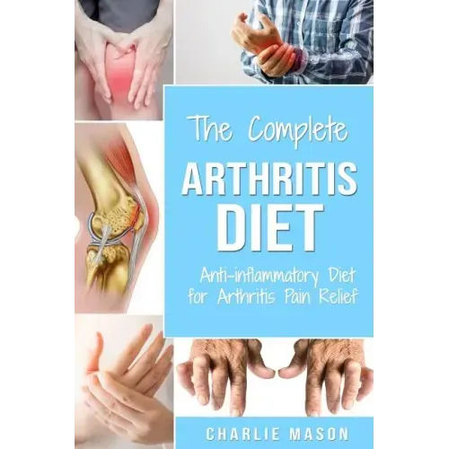 Arthritis Diet: Anti-inflammatory Diet for Arthritis Pain Relief: Arthritis Arthritis Books Arthritis Diet Book Reversed Pain Relief Diet Plan Treatme