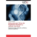 Infeccion Por Virus de Papiloma Humano y Cancer Cervical