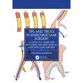 Tips and Tricks in Endovascular Surgery: A "How to" Guide for reaching the next Level in Endovascular Surgery