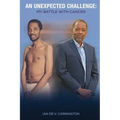 An Unexpected Challenge: My Battle with Cancer