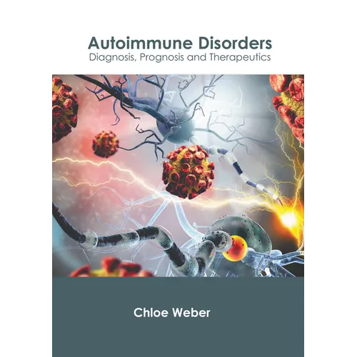 Autoimmune Disorders: Diagnosis, Prognosis and Therapeutics
