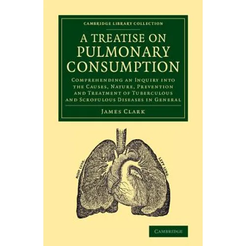 A Treatise on Pulmonary Consumption: Comprehending an Inquiry Into the Causes, Nature, Prevention and Treatment of Tuberculous and Scrofulous Diseas