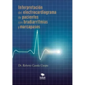Interpretación del electrocardiograma de pacientes con bradiarritmias y marcapasos