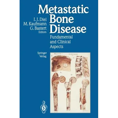 Metastatic Bone Disease: Fundamental and Clinical Aspects