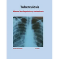 Tratamiento de Tuberculosis: Manual de diagnóstico y tratamiento