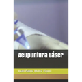 Acupuntura Láser