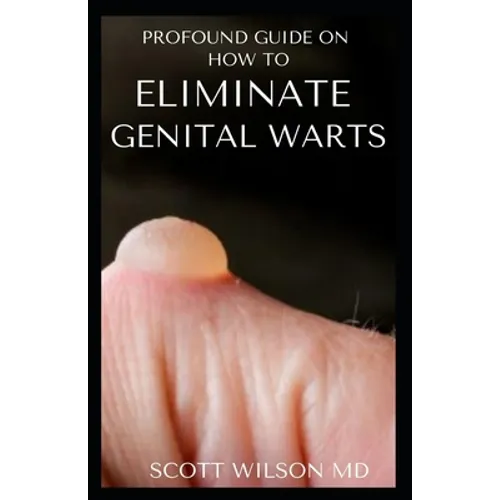 Profound Guide to Eliminate Genital Warts: The Ultimate Guide To Eliminate Genital Warts