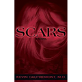 Scars