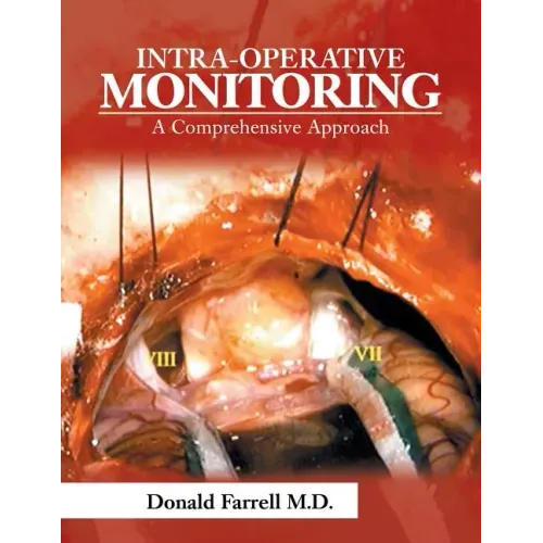 Intra-Operative Monitoring: A Comprehensive Approach