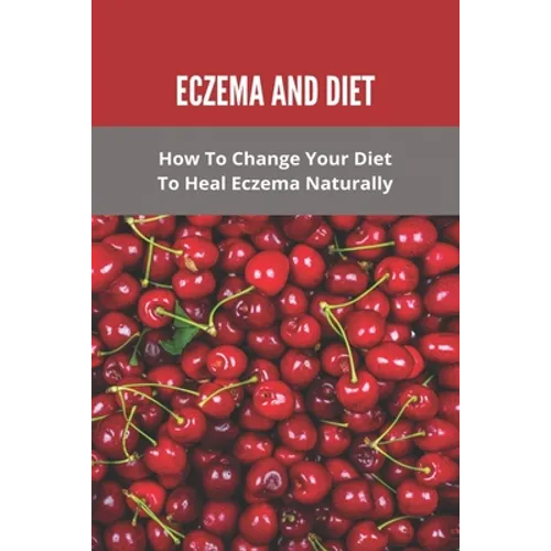Eczema And Diet: How To Change Your Diet To Heal Eczema Naturally: How To Treat Eczema With Diet