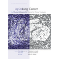 Lung Cancer: Disease Biology and Its Potential for Clinical Translation