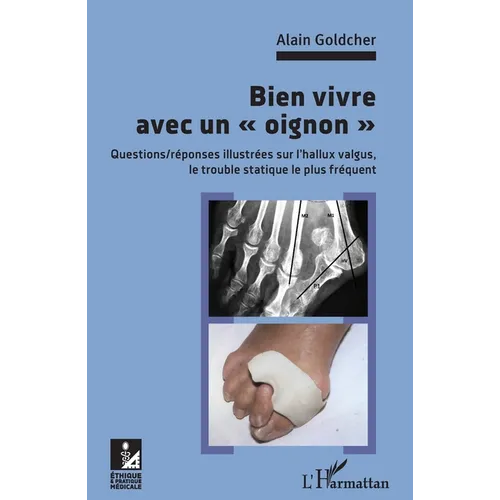 Bien vivre avec un "oignon": Questions/réponses illsutrées sur l'hallux valgus, le trouble statique le plus fréquent