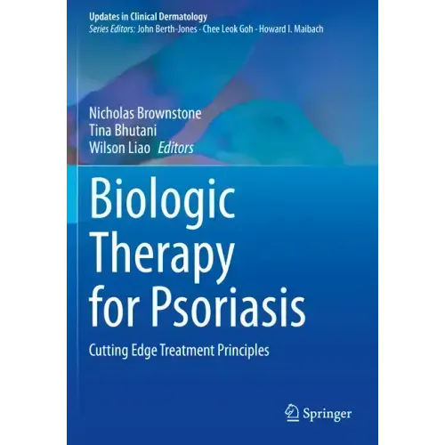 Biologic Therapy for Psoriasis: Cutting Edge Treatment Principles
