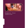 Diabetic Foot Infection
