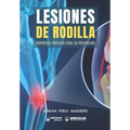 Lesiones de rodilla: Propuesta práctica para su prevención
