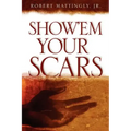 Show'em Your Scars